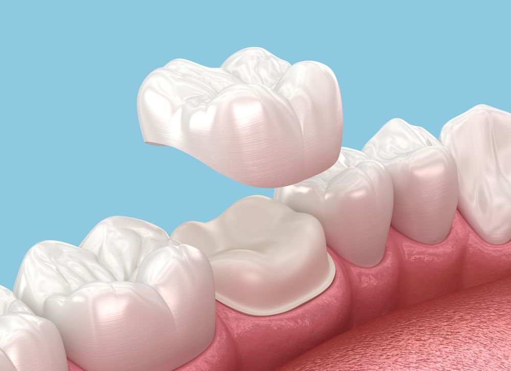 Mithra Dental Care
