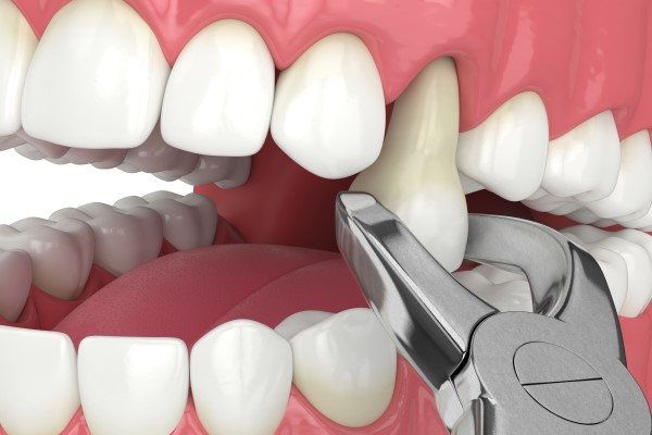 Mithra Dental Care