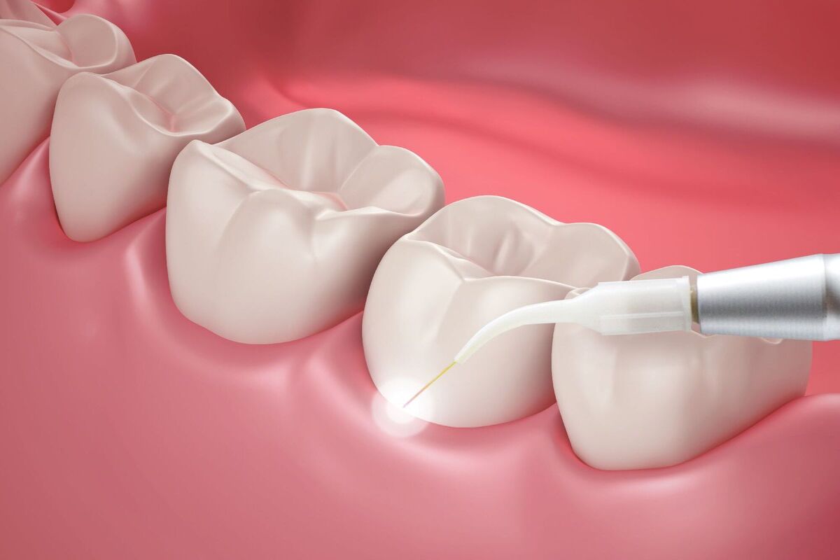 Mithra Dental Care