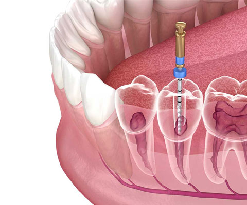 Mithra Dental Care