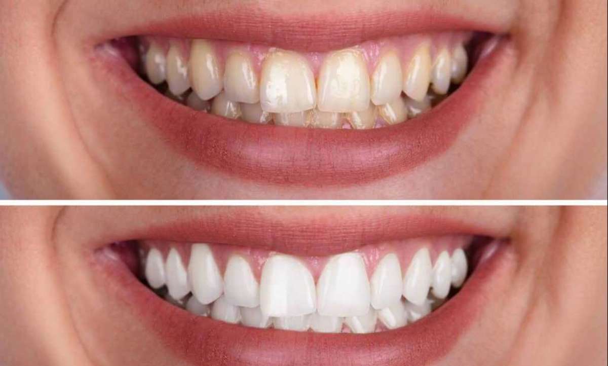 Mithra Dental Care