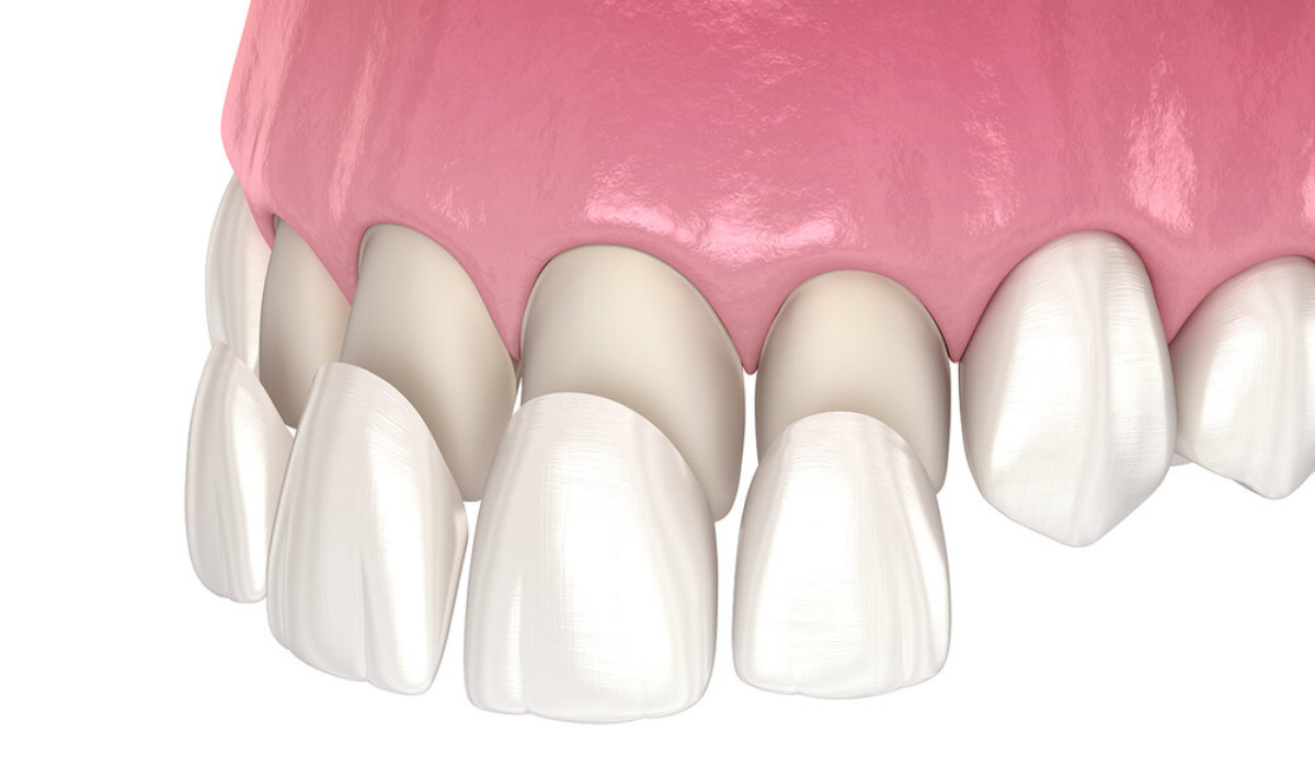 Mithra Dental Care